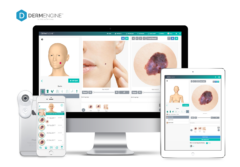 DermEngine