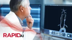 Rapid SDH