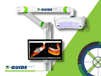 X-Guide Surgical Navigation System
