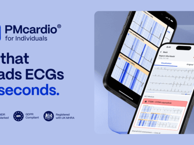 PMcardio
